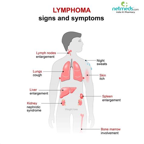 Lymphoma .